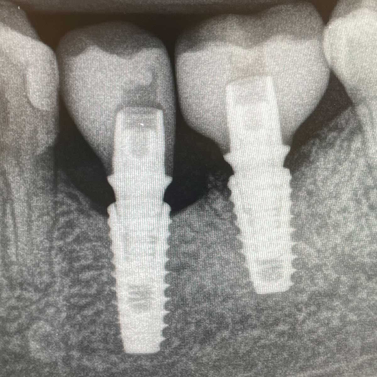 Gianluigi Bittante-75