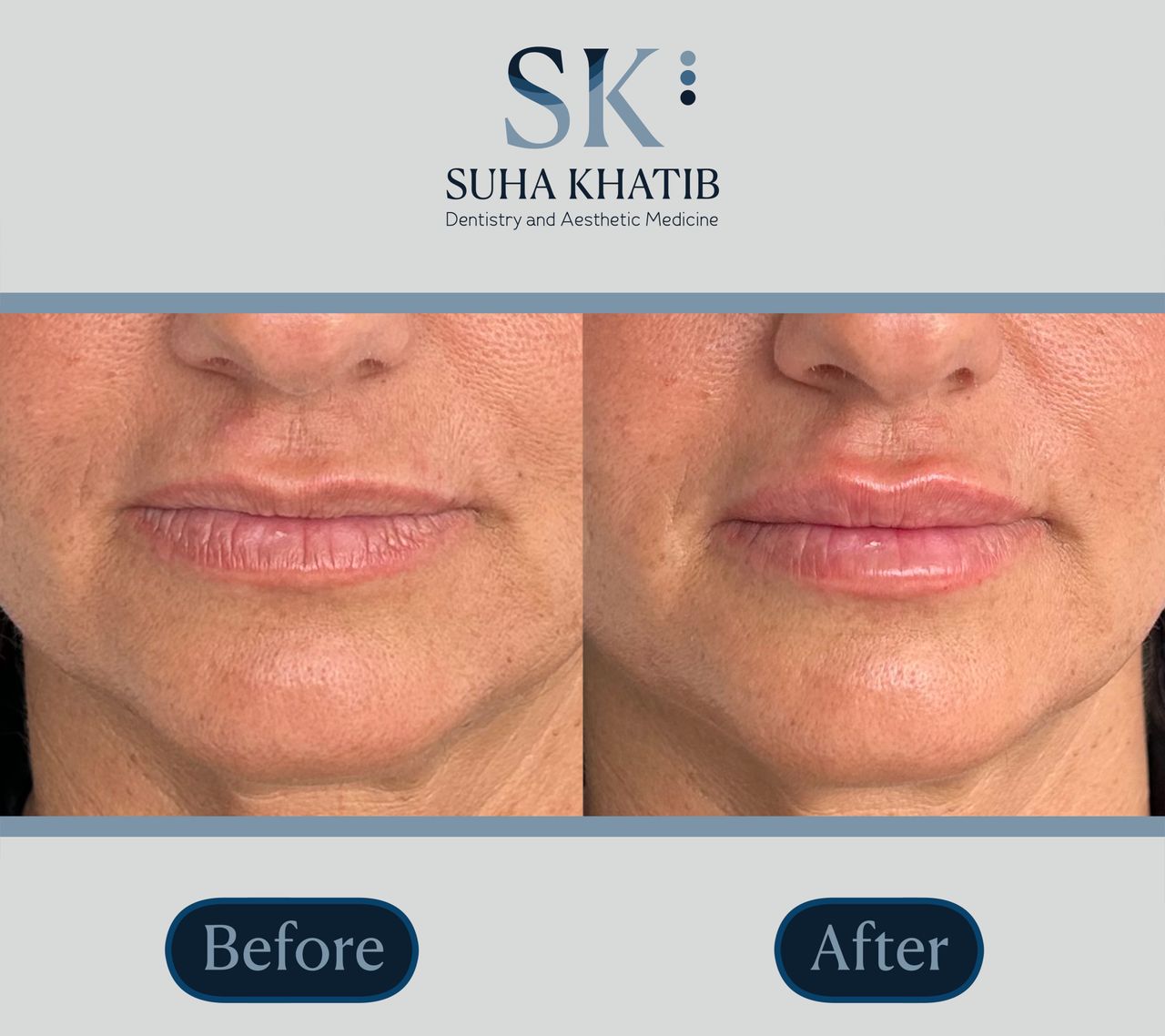 Suha Khatib-10