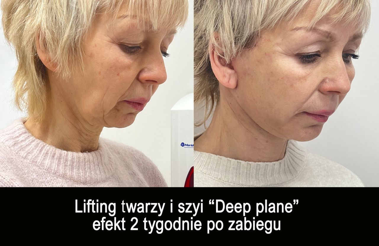 Mariusz Zagajewski-45