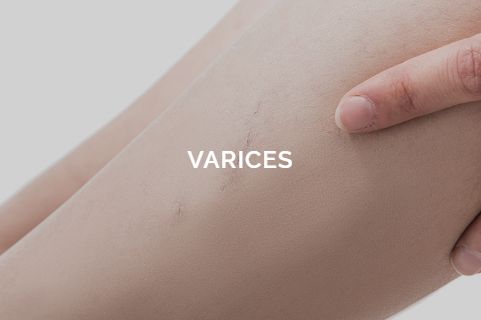 Raquel Moreno Pentinel-28