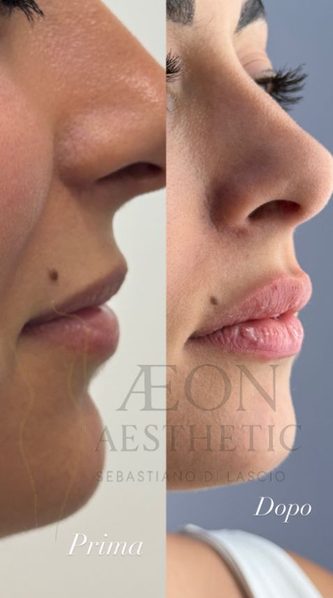 Sebastiano Di Lascio-0