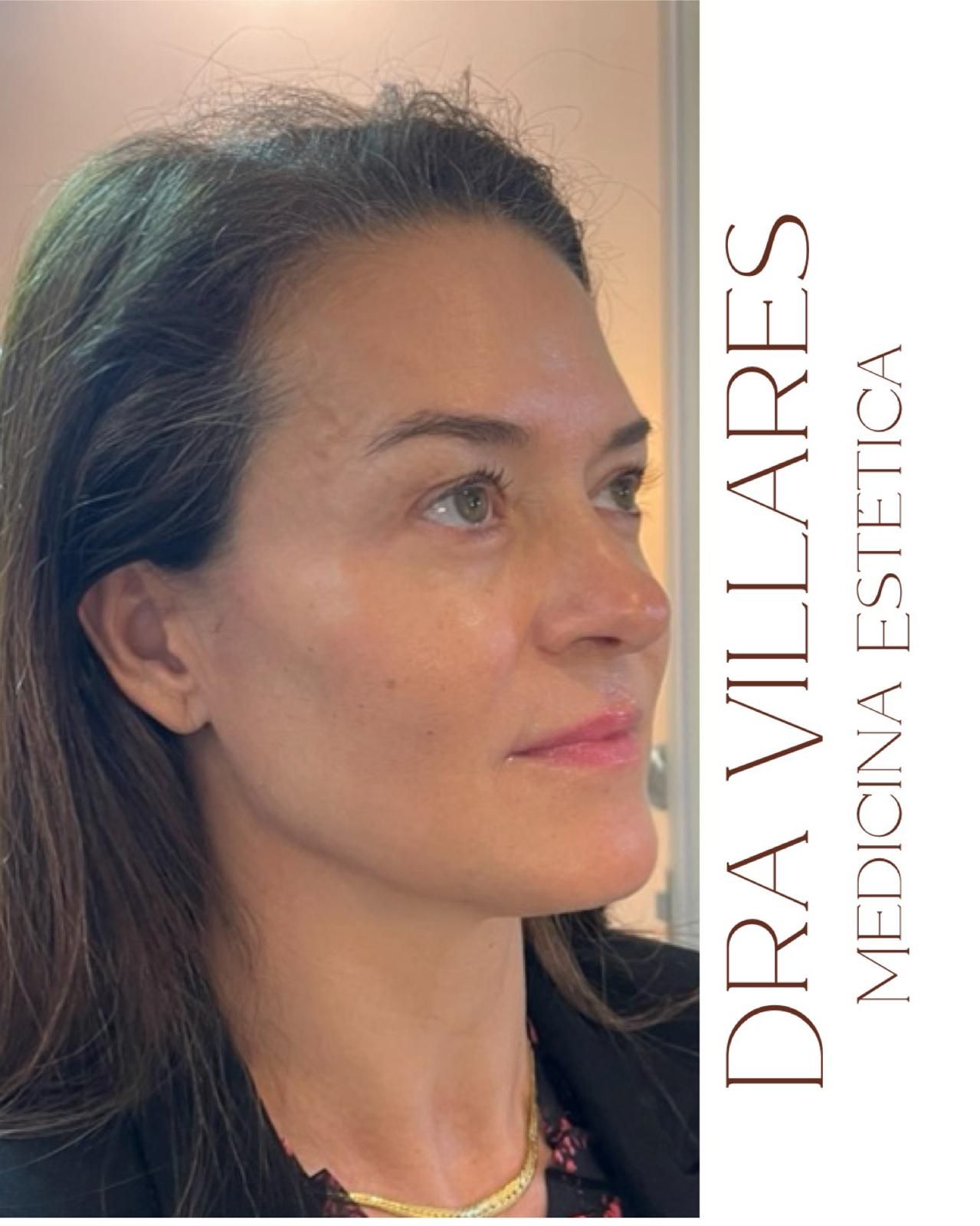 Maria Jose Villares Moreno-4