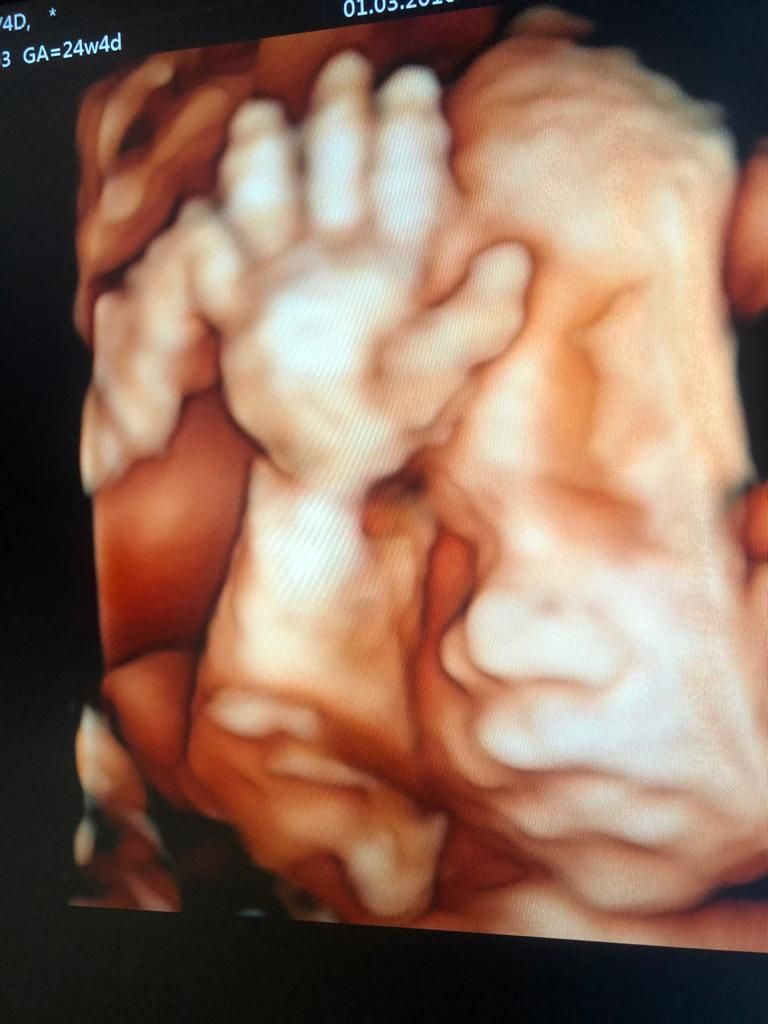 Dilek Turğut Kestane-14