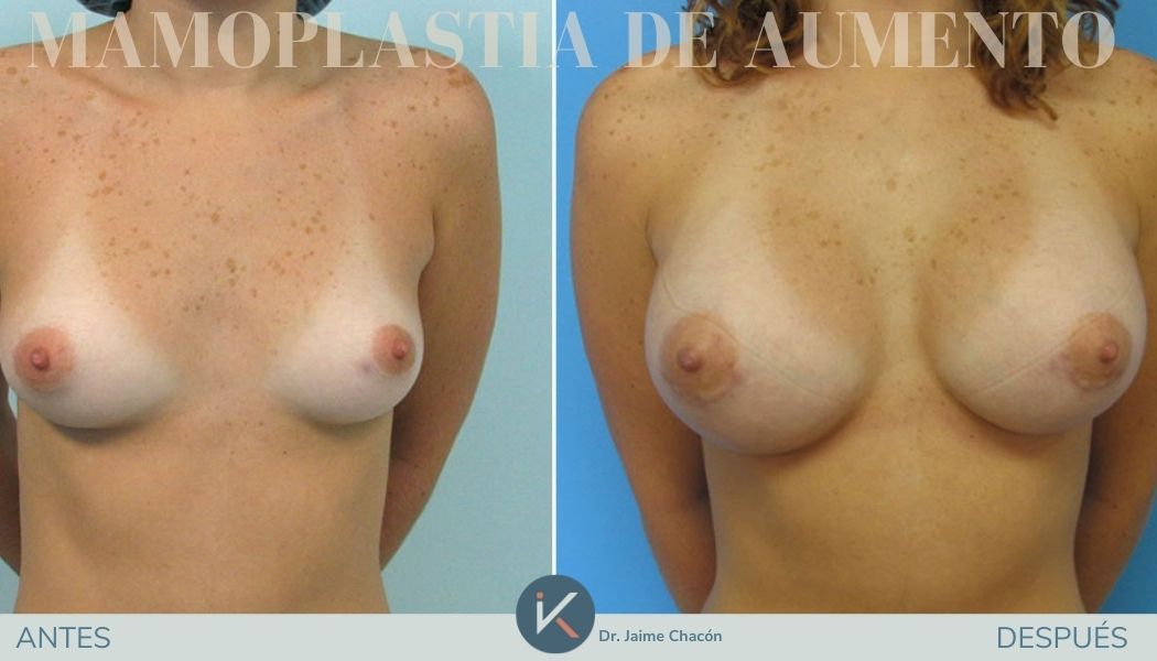 Jaime Eduardo Chacón Hernández-14