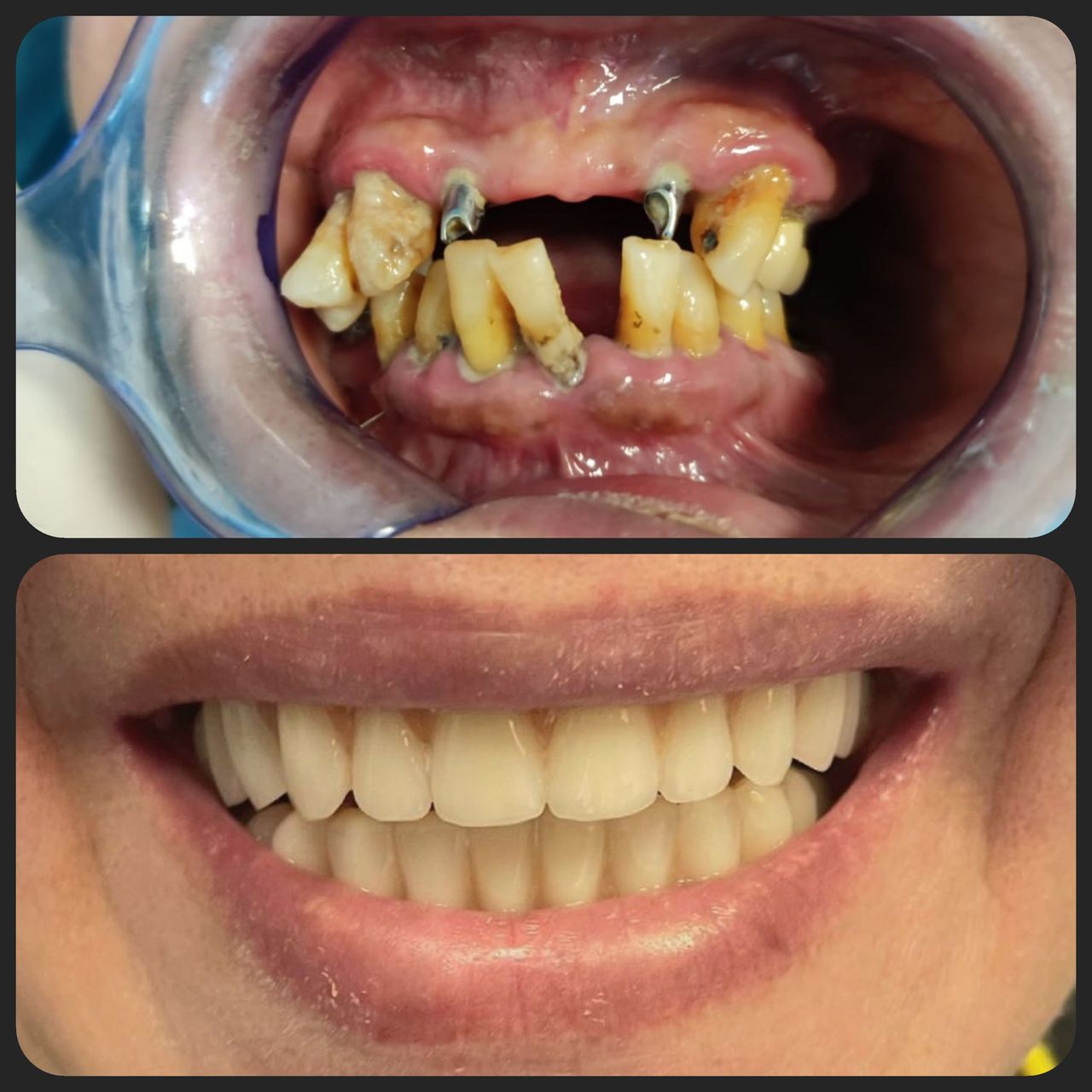 Lorenzo Paolo Bottini-2