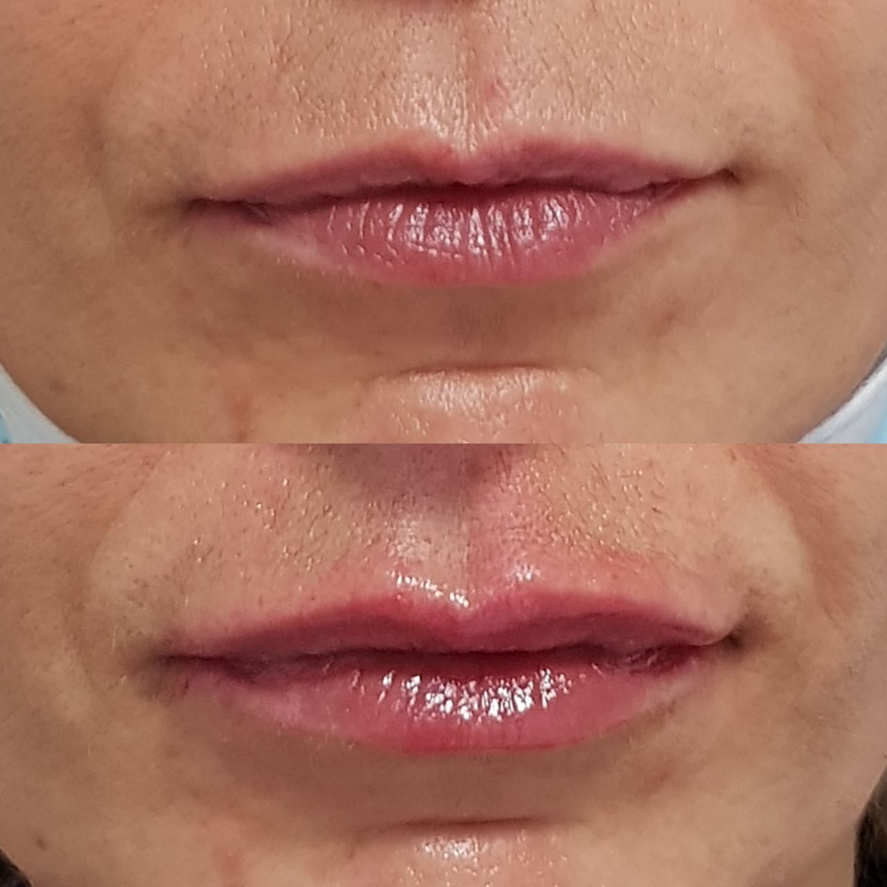 Rosalba Herrero Zerpa-280