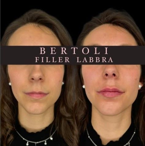 Andrea Bertoli-18