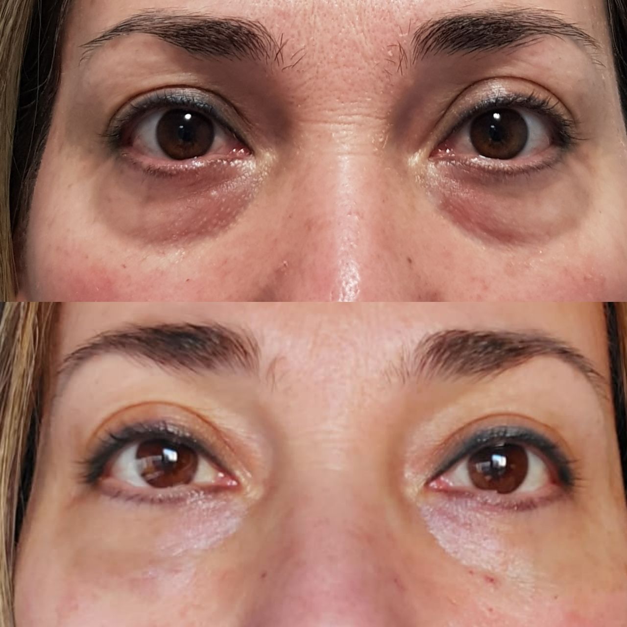 Rosalba Herrero Zerpa-301