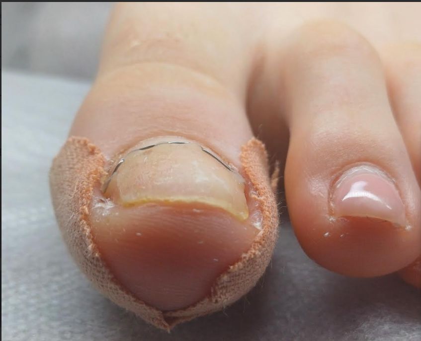 Halyna Strykharchuk -0