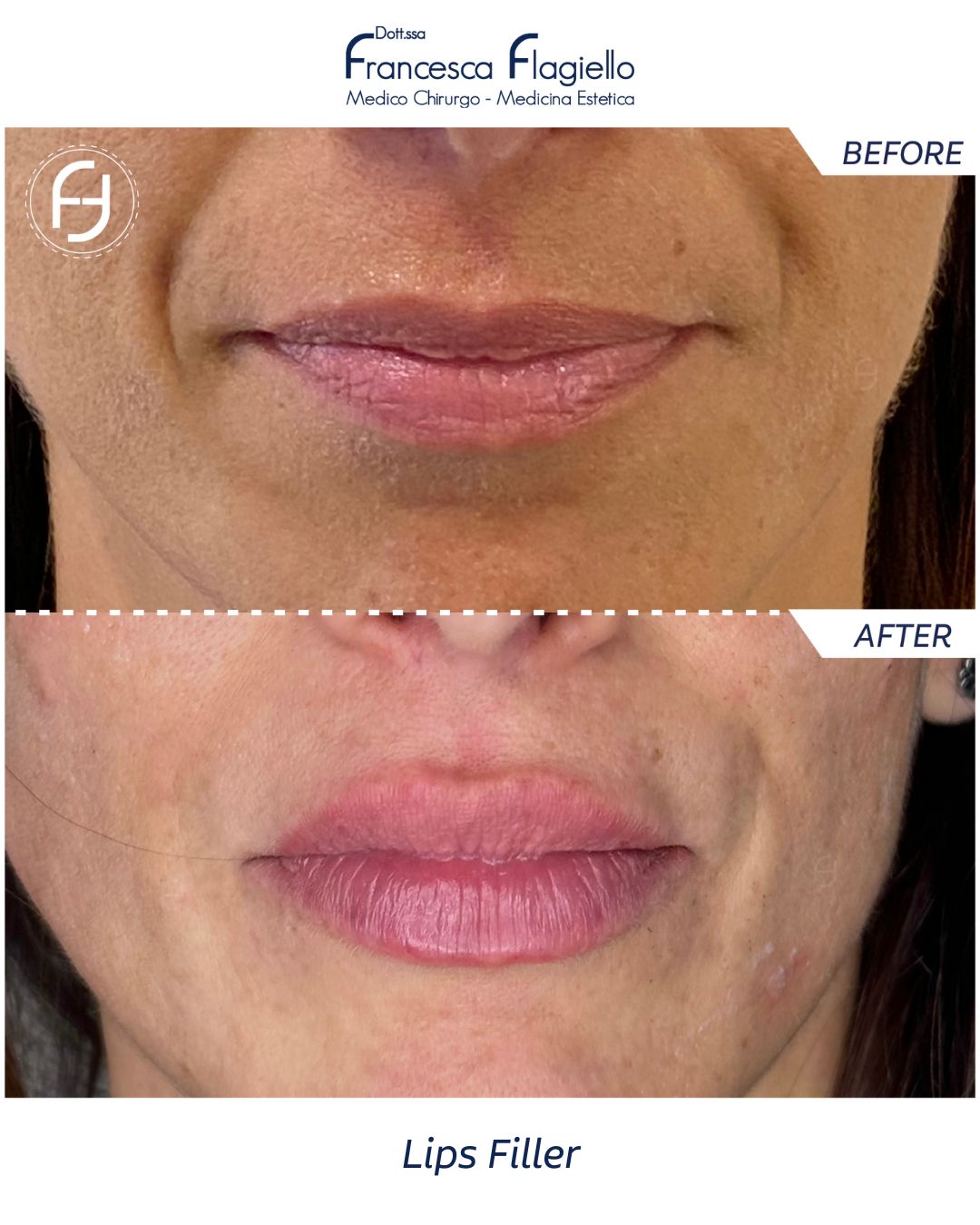 Francesca Flagiello-24