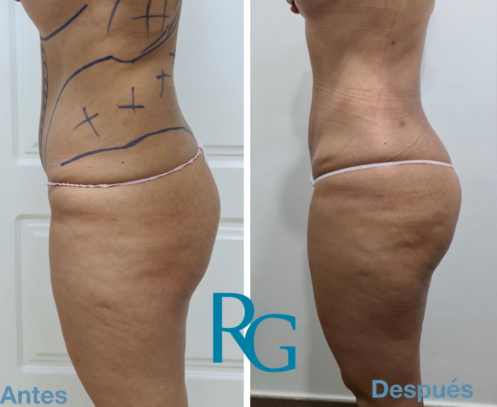 Rafael Gonzalez Oñate-14