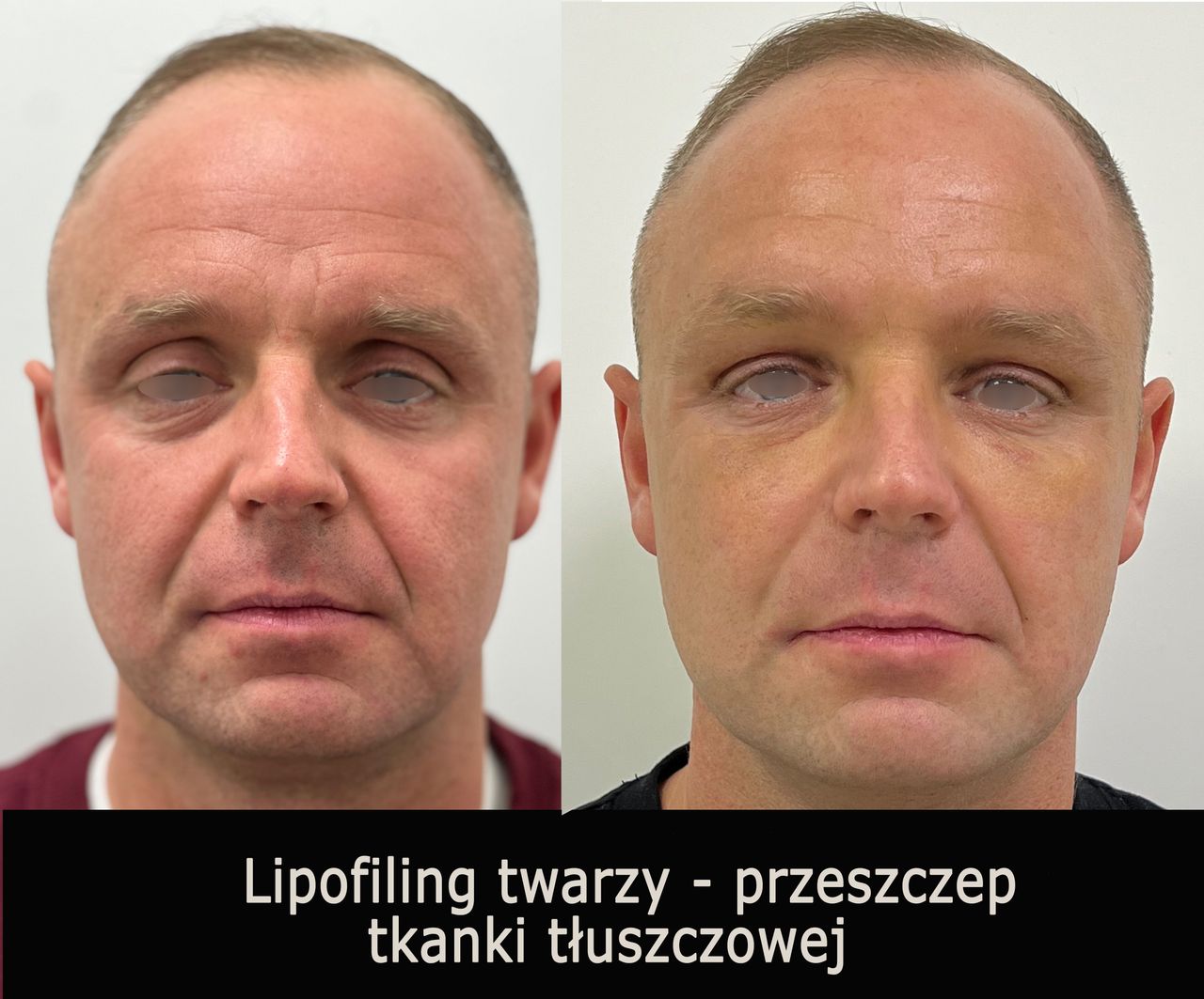 Mariusz Zagajewski-14