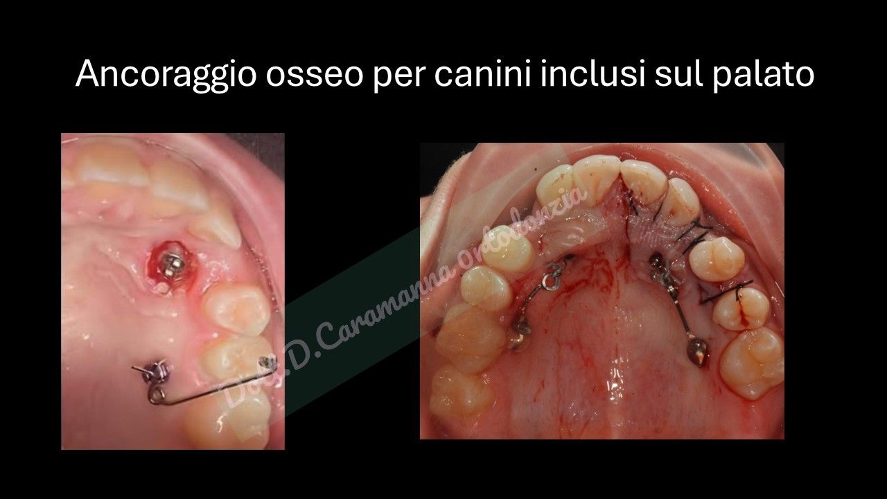 Daniele Caramanna-35