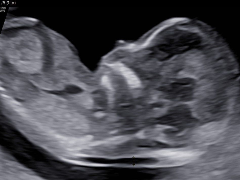 Valentina Conserva-7