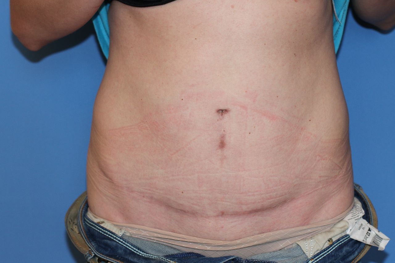 Maciej Charaziński-137