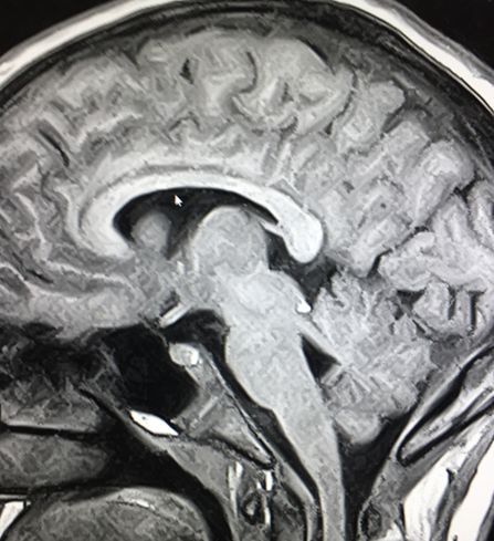 Cornelia Schröder-10