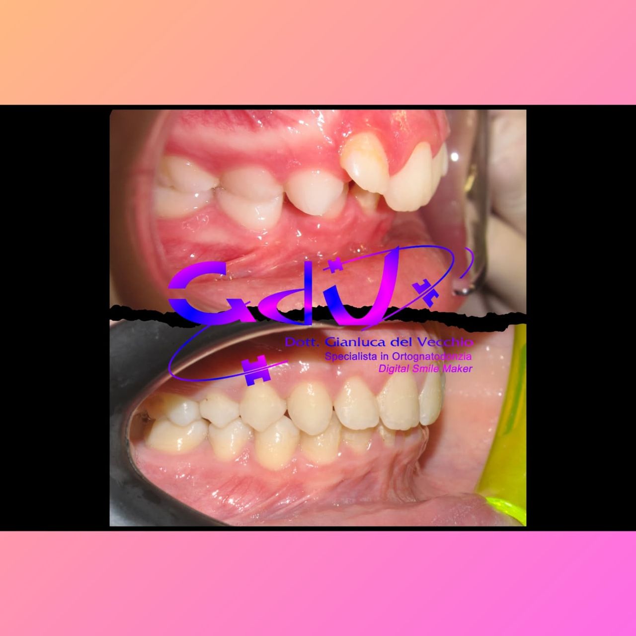 Gianluca Del Vecchio-153