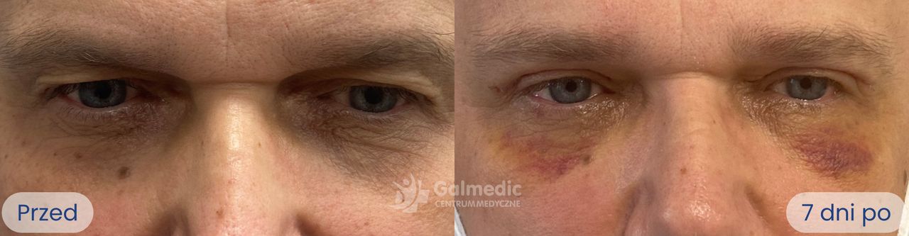 Jakub Staniszewski-5