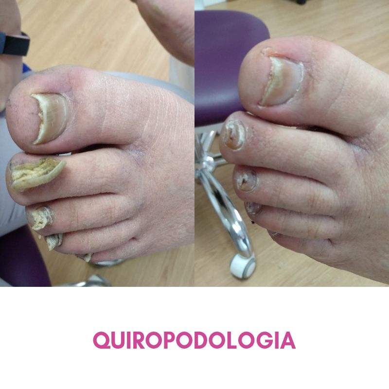 Salomé Antón Arnal-25