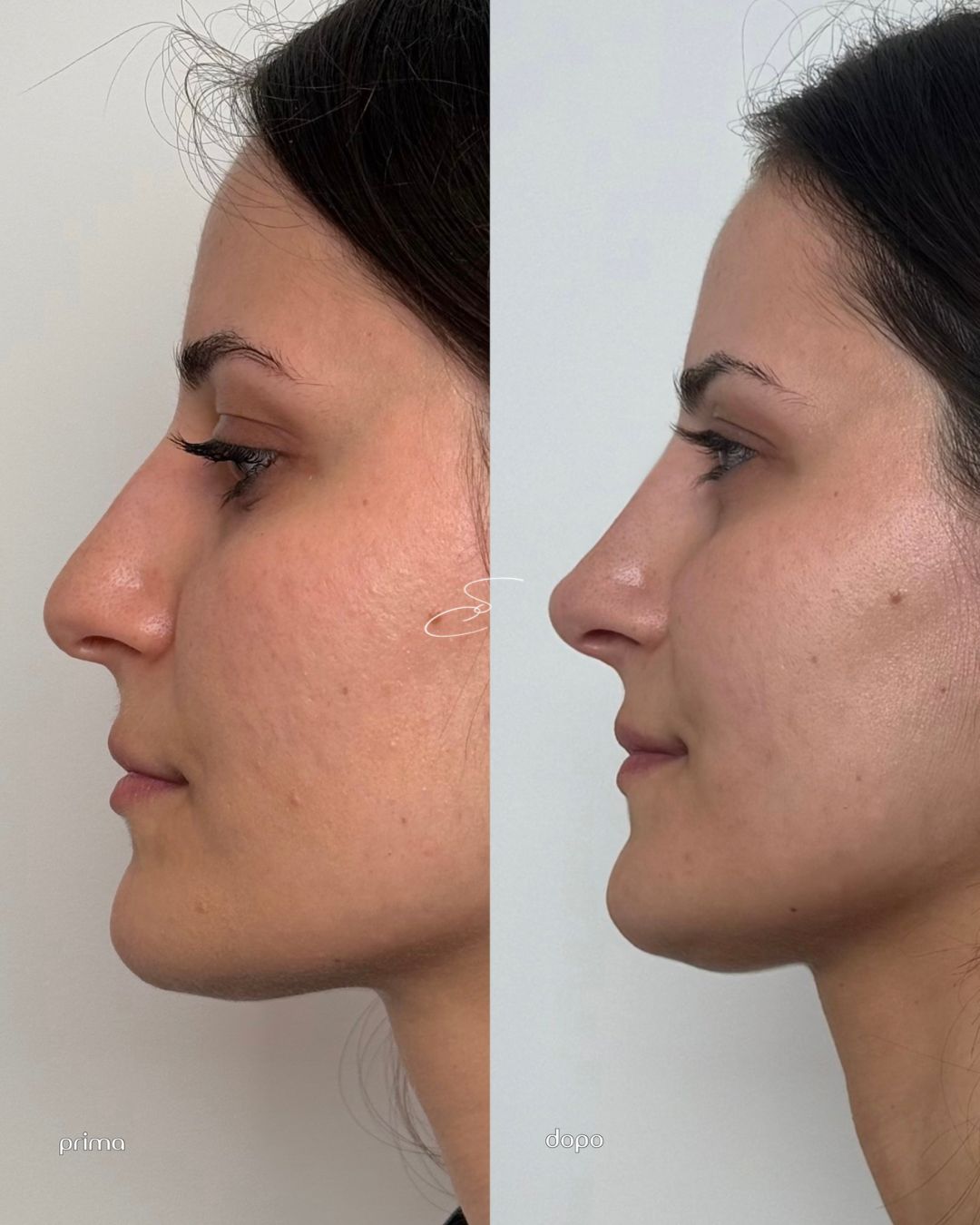 Sally Capuano-238