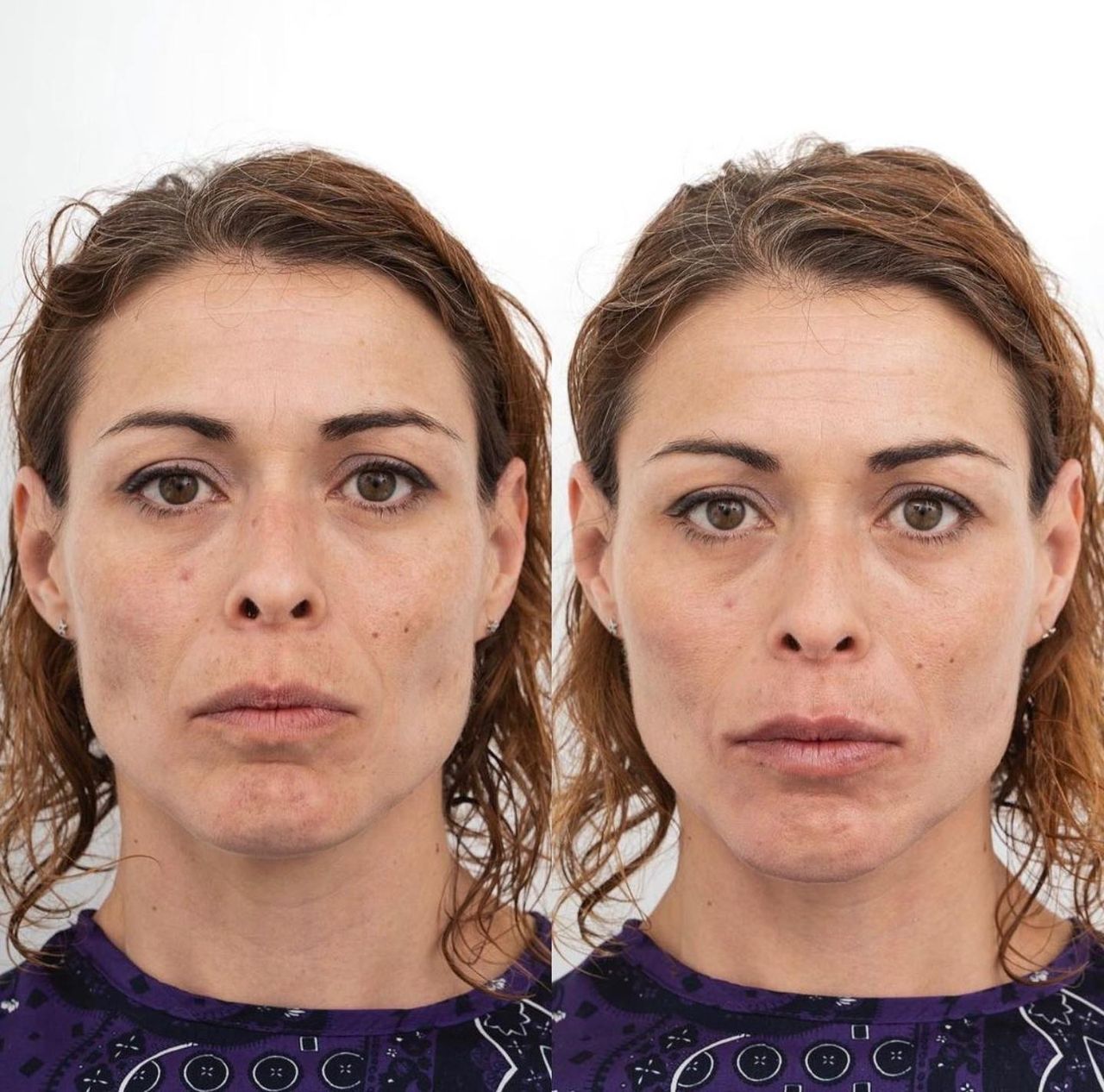 Raquel Moreno Pentinel-62