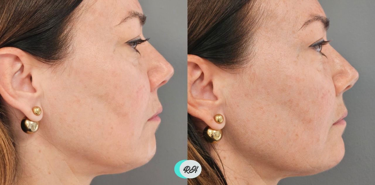 Rosalba Herrero Zerpa-611