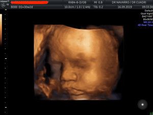 José Antonio Navarro Repiso-6