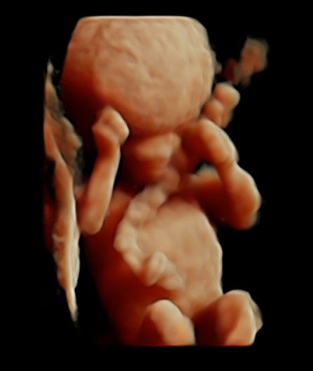 Tommaso Incandela-15