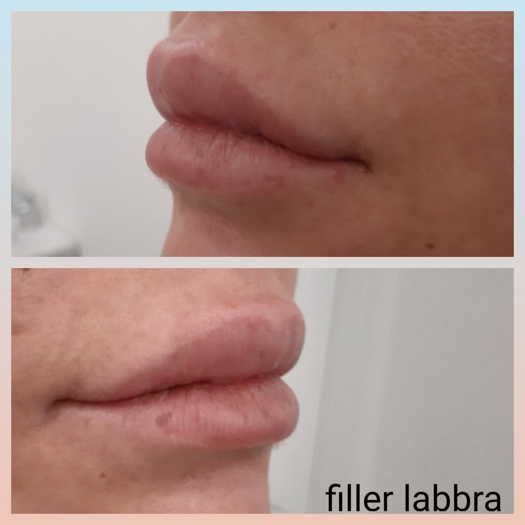 Paola Della Rocca-19