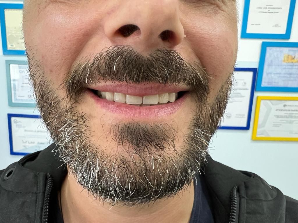 Luigi Aiardo Esposito-8