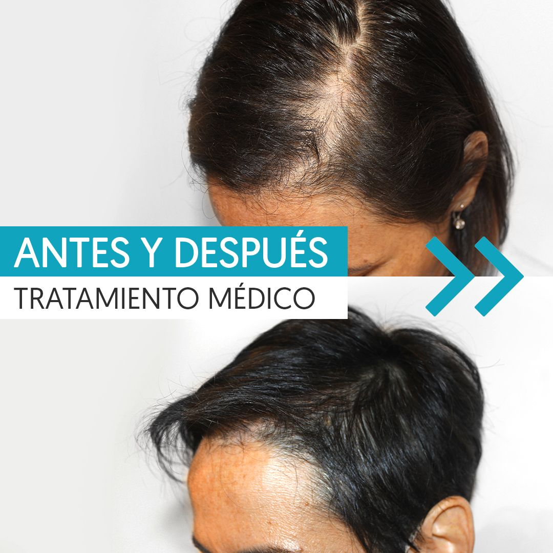 Karlexis León Montilla-7