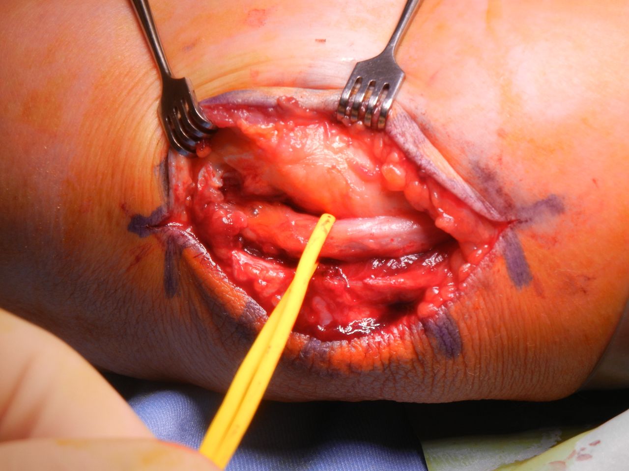 Alessandro Macchiavello-6