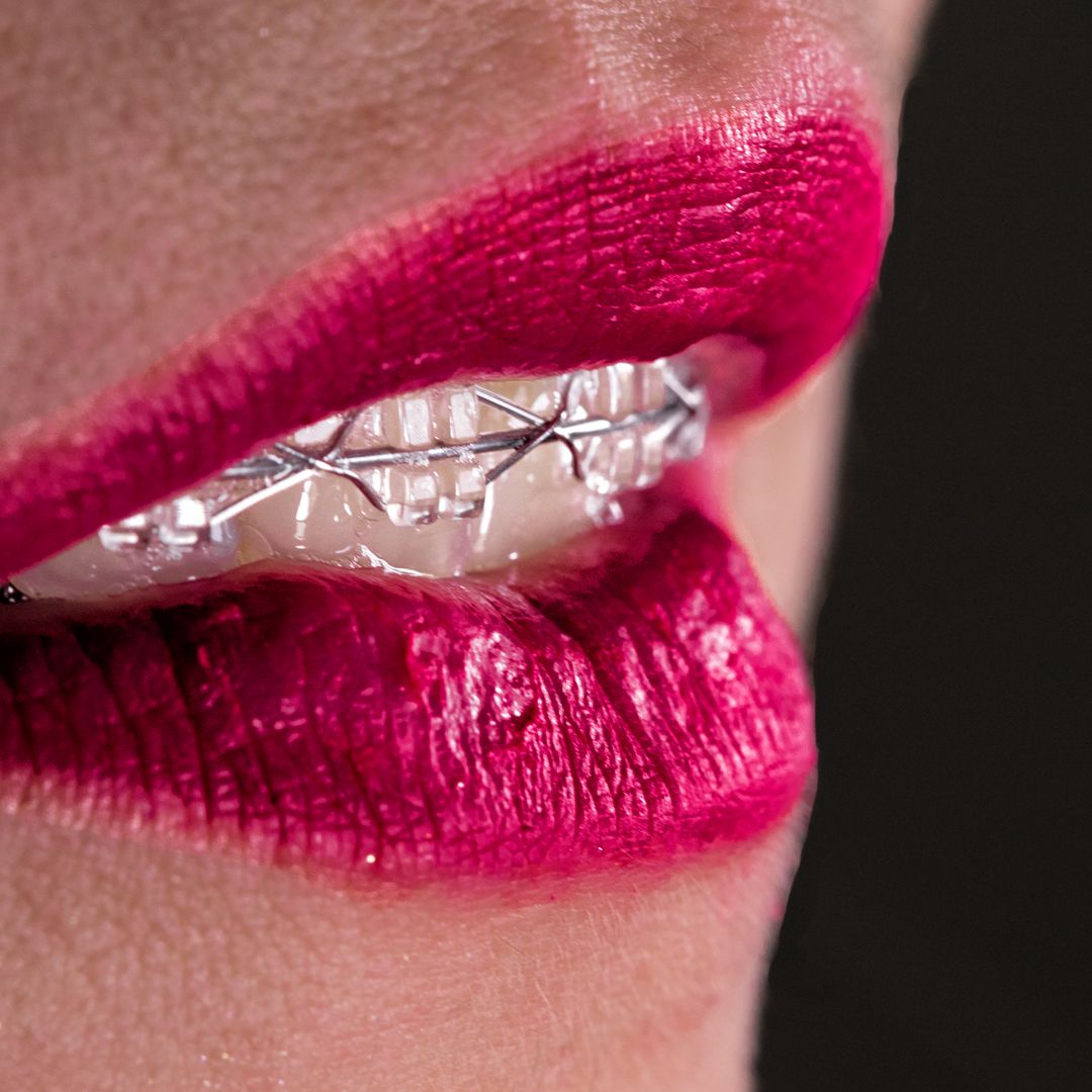 Juan Carlos Sánchez Pérez-30