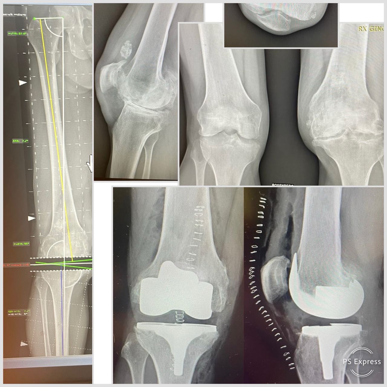 Pierpaolo Ciprini-11