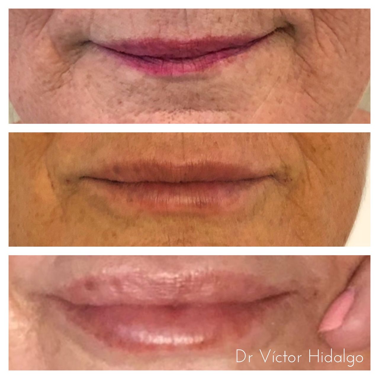 Víctor Hidalgo López-12