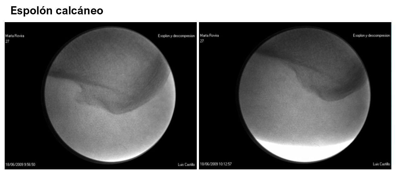 Luis Castillo Sanchez-9