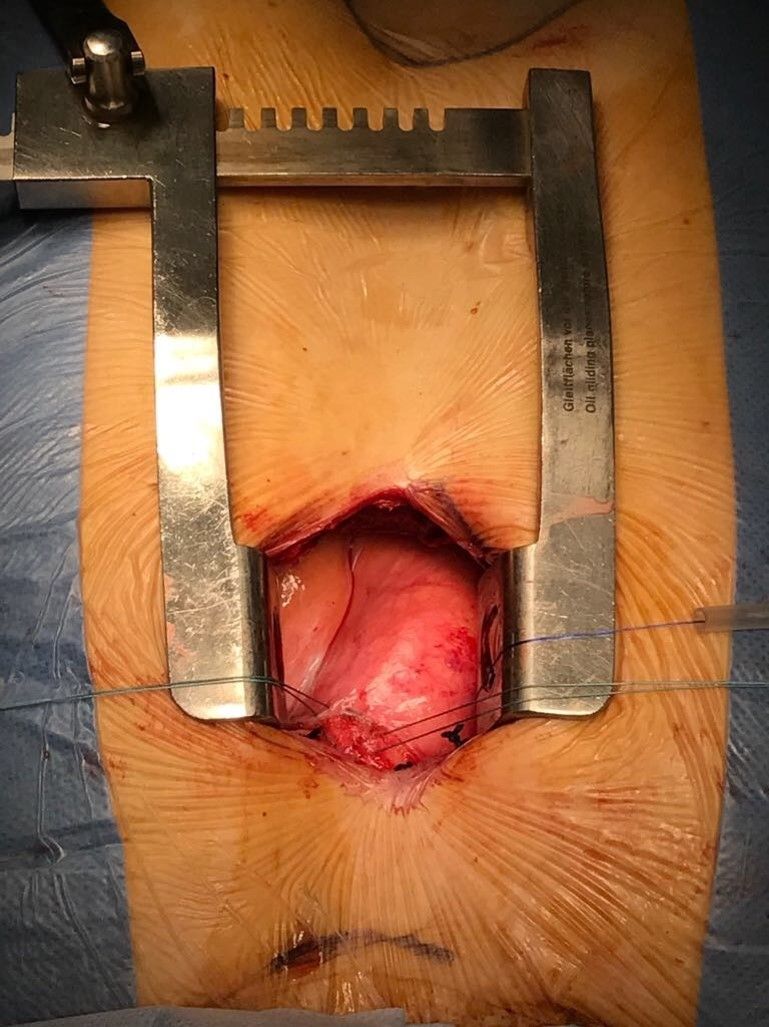 Guillermo Reyes Copa-4