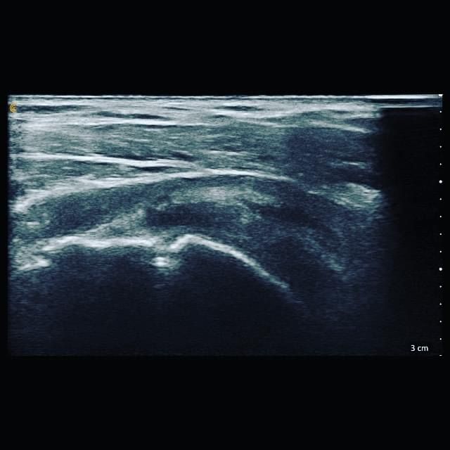 Jacopo Pettinelli-10