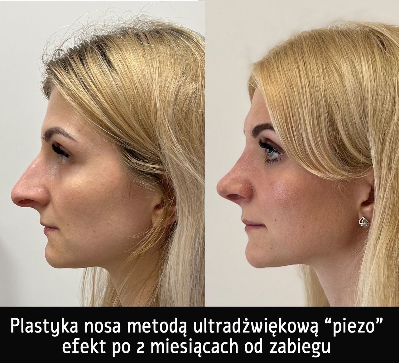 Mariusz Zagajewski-1