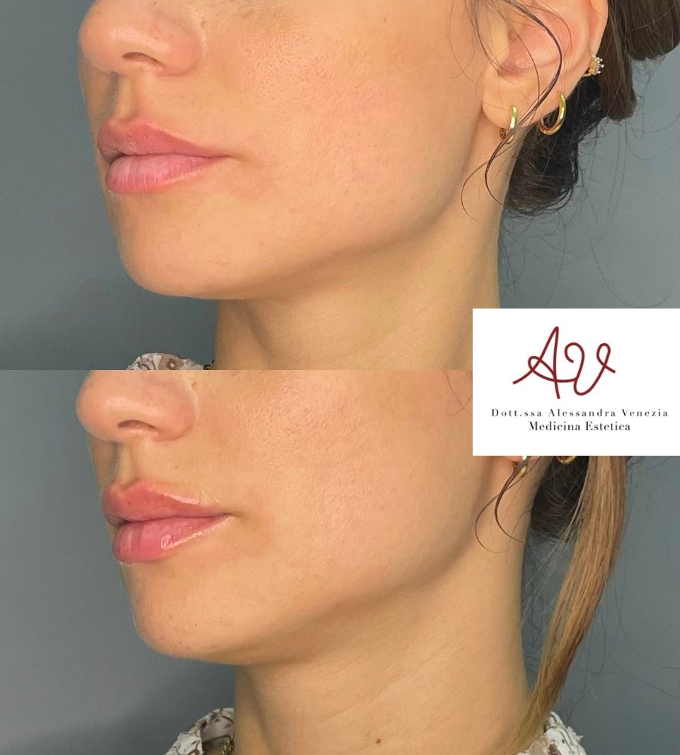 Alessandra Venezia-41