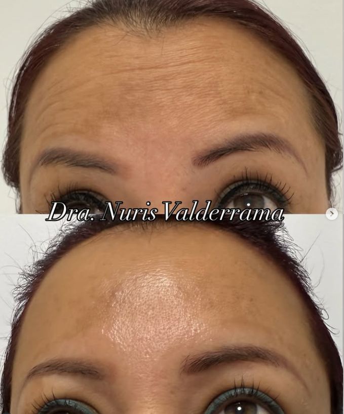 Nuris Dariela Valderrama Villanueva-3