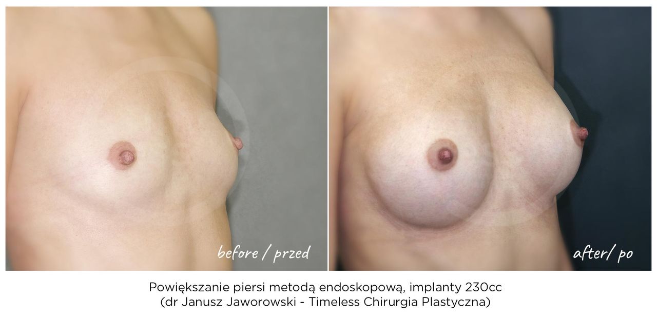 Janusz Jaworowski-175