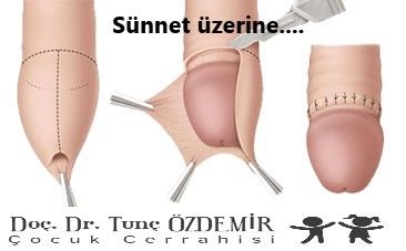 Tunç Özdemir-18