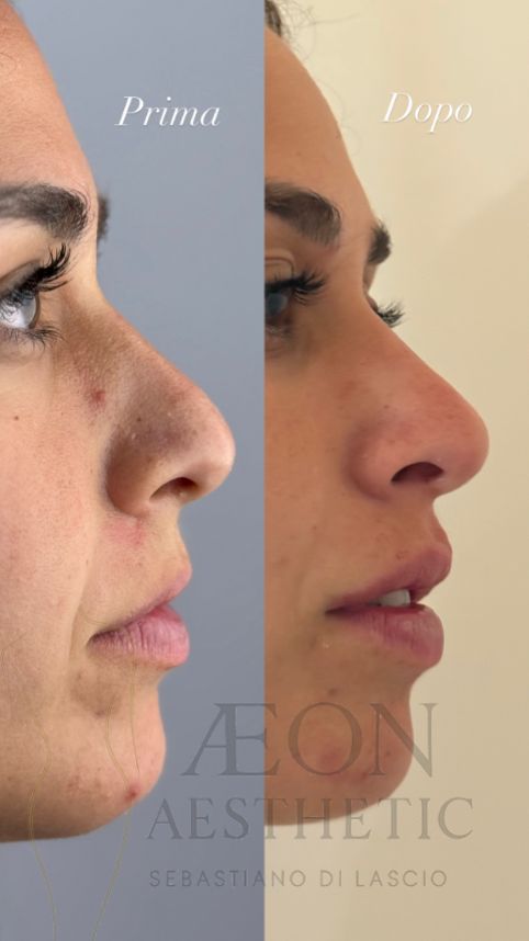 Sebastiano Di Lascio-3