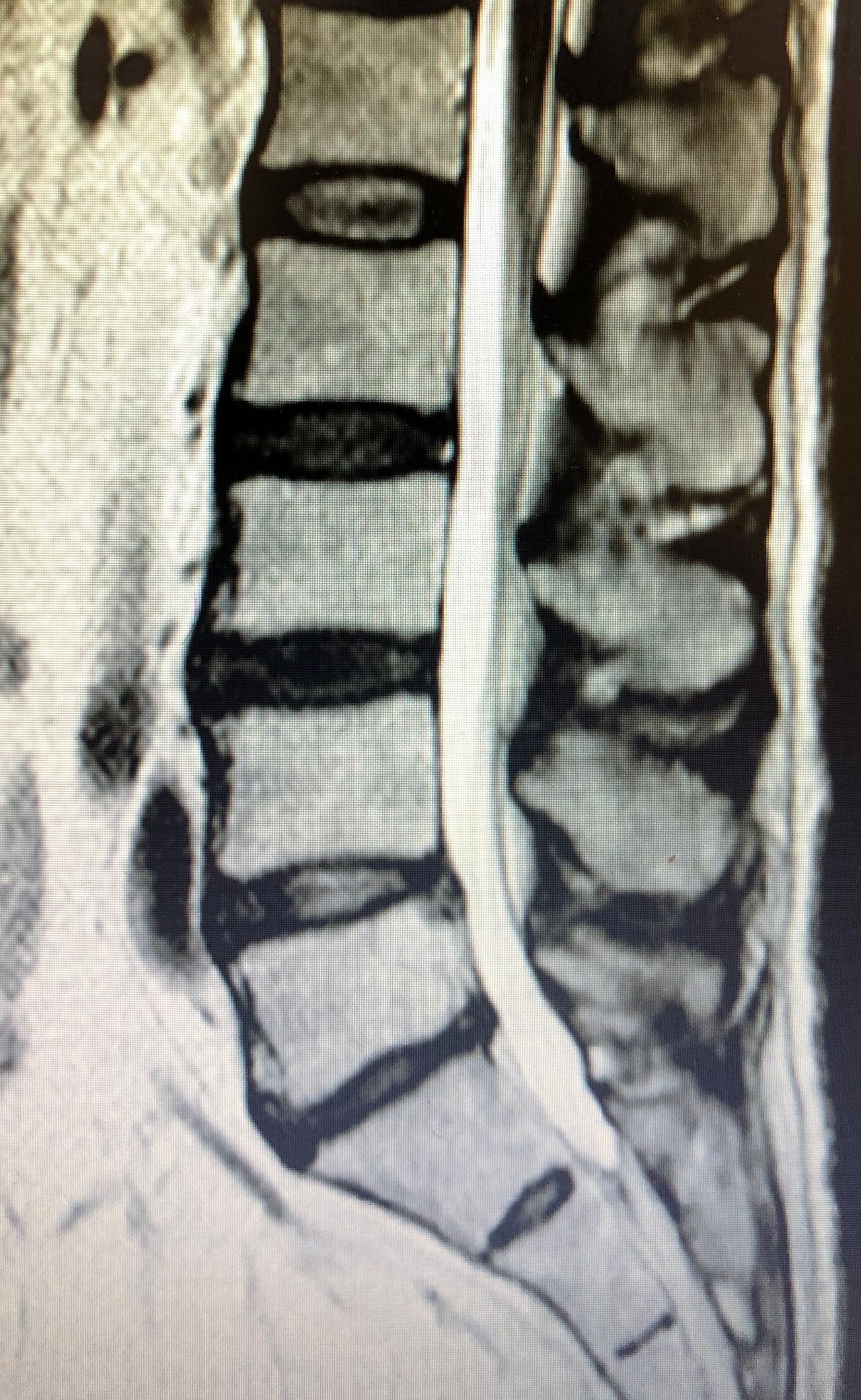 Vincenzo Pipitone-18