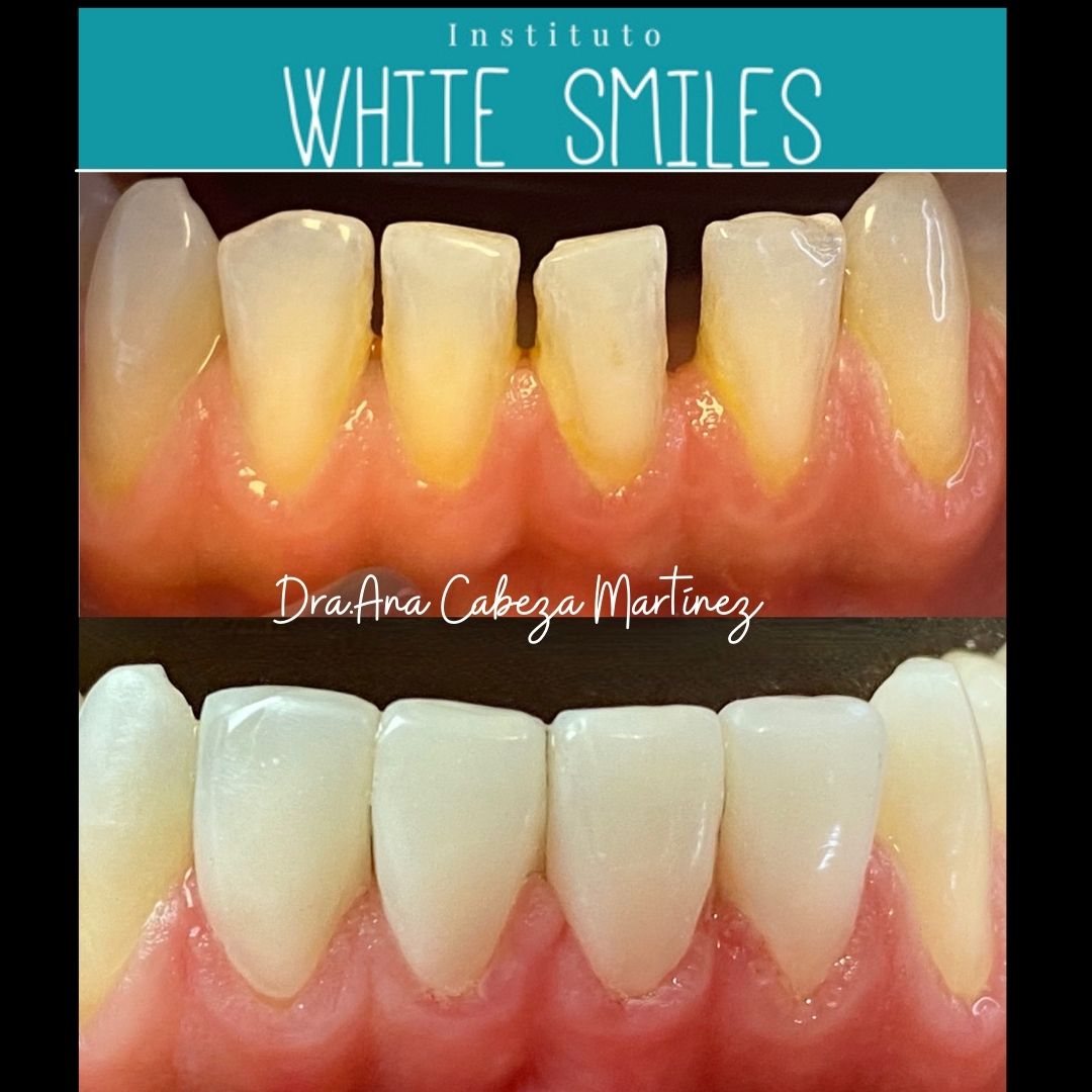 Ana Cabeza Martinez-24