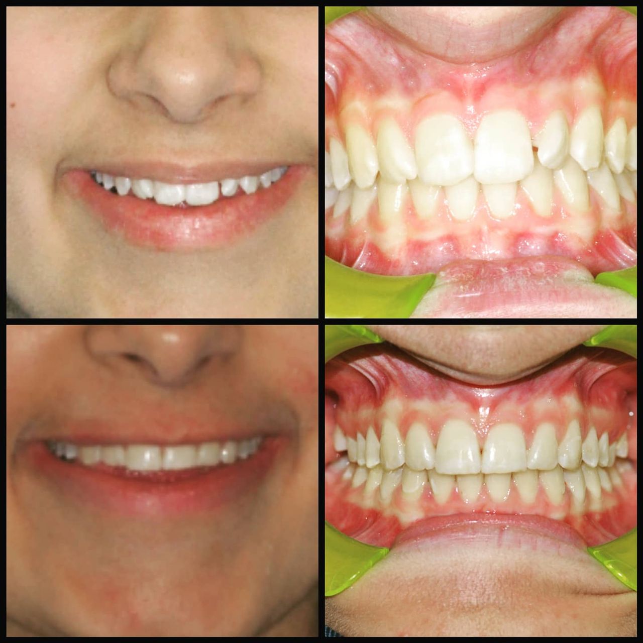 Gianluca Del Vecchio-36