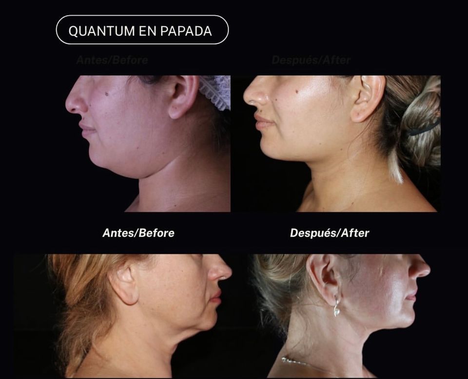 Raffaele Del Prete-20