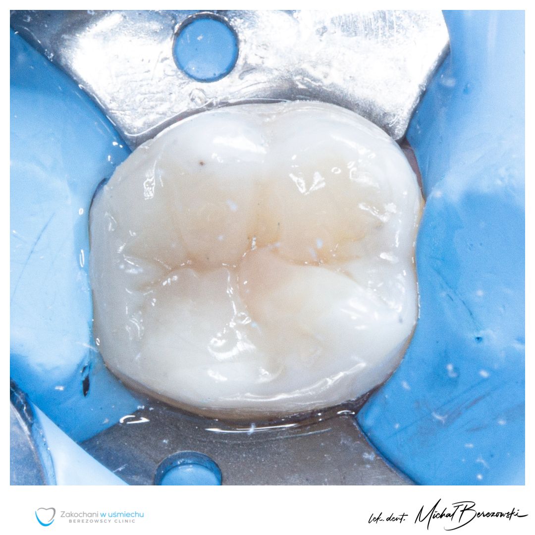 Michał Berezowski-36