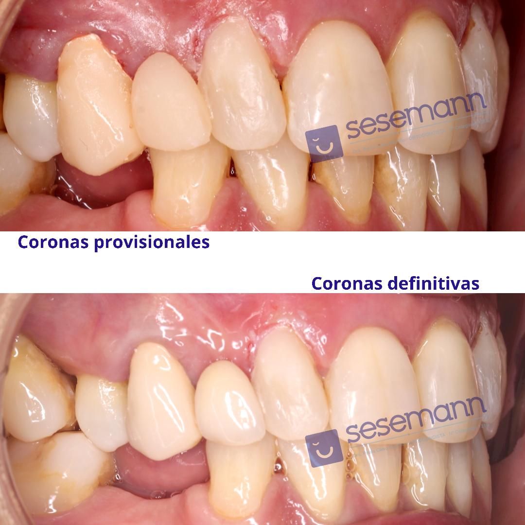 Paula Cano Carrillo-82